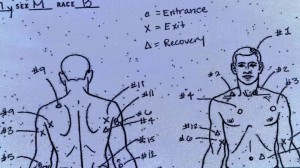 Laquan McDonald Entry and Exit Wounds Diagram